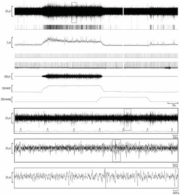 The Role of Central Command in the Increase in Muscle Sympathetic Nerve Activity to Contracting Muscle During High Intensity Isometric Exercise